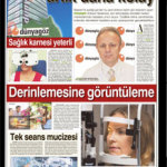 retina-daha-kolay